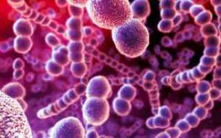 Streptococcus pneumoniae в горле что это такое