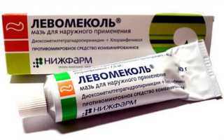 Короткая уздечка полового члена: причины, симптомы, диагностика и лечение