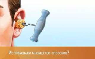Возможные причины заложенности уха при насморке. Лечение